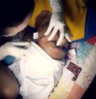 A Thread Rhytidectomy Is A Safe, Convenient Alternative To Traditional Rhytidectomy